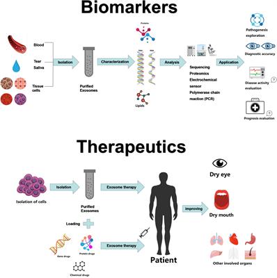 Recent Advances in the Use of Exosomes in Sjögren’s Syndrome